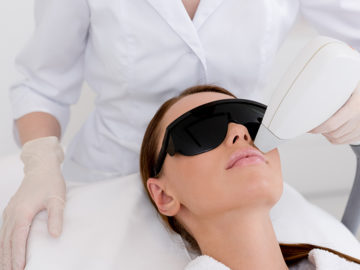 laser-hair-removal-360x270